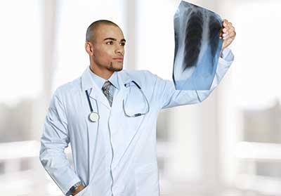 IVC Filter