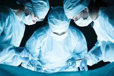 IVC Filter
