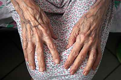 Nursing Home Texas