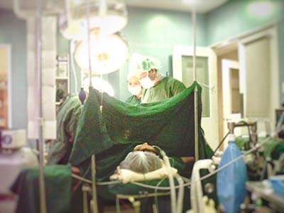 IVC Filter Surgical Procedure