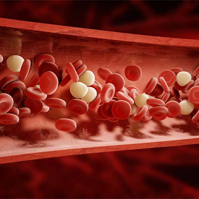 Blood Clots