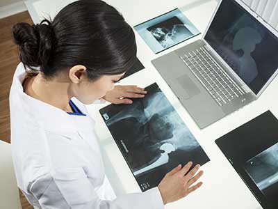 Hip Xray