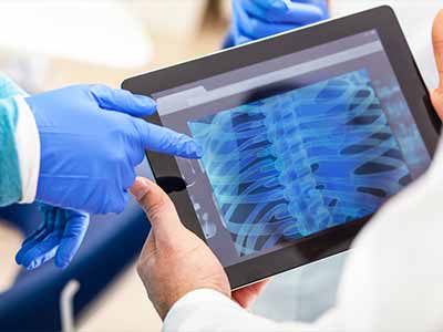 chest-xray