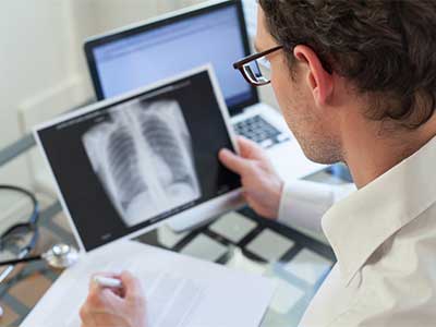 Differences Between Asbestosis & Mesothelioma