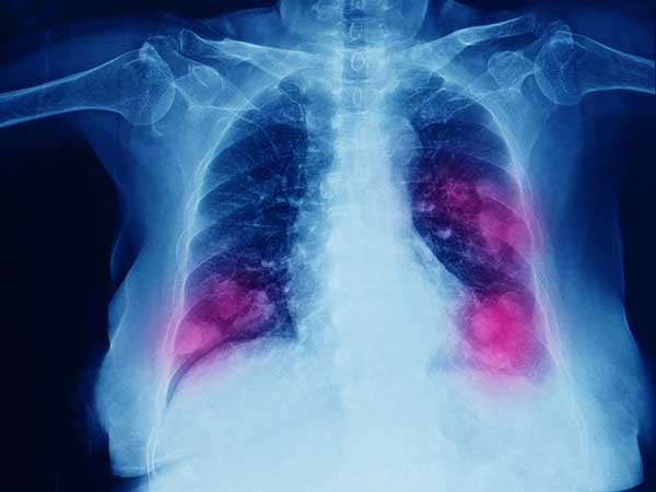 what kind of doctor should i see for copd